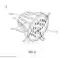 Fig. 03 - LED LIGHTING DEVICE WITH EXCELLENT HEAT DISSIPATION PROPERTY