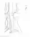 Fig. 03 - Control arm for a motor vehicle