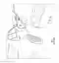 Fig. 02 - Self-Coiling Dent Guard