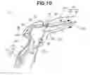 Fig. 11 - Upper vehicle body structure of automobile