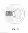 Fig. 02 - VEHICLE TIRE TRACTION DEVICE
