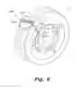 Fig. 12 - VEHICLE TIRE TRACTION DEVICE