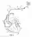 Fig. 02 - Lead adapter for testing pacing thresholds across multiple vectors at implant
