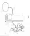Fig. 03 - User interfaces for dialysis devices