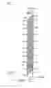 Fig. 03 - Liquid ejection apparatus and storage medium storing program