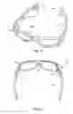 Fig. 05 - Eyewear with removeable secured adjustable strap