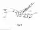 Fig. 08 - Eyewear with removeable secured adjustable strap