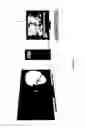 Fig. 04 - Visual perimeter measurement system and method