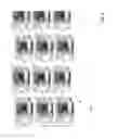Fig. 06 - Matching imaging data to flexographic plate surface