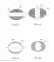 Fig. 06 - Fluid lens assembly