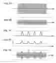 Fig. 07 - Audio-Signal Processing Apparatus and Method, and Program