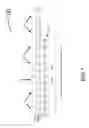 Fig. 07 - ADAPTIVE NOISE CANCELLATION