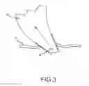 Fig. 04 - Determination of cardiac geometry responsive to doppler based imaging of blood flow characteristics