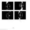 Fig. 07 -  METHOD AND SYSTEM OF DETERMINING A GRADE OF NUCLEAR CATARACT