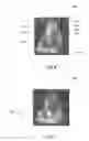 Fig. 07 - METHOD AND APPARATUS FOR PROVIDING MOTION-COMPENSATED IMAGES