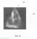 Fig. 08 - METHOD AND APPARATUS FOR PROVIDING MOTION-COMPENSATED IMAGES