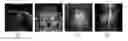Fig. 01 - Image reconstruction