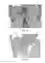 Fig. 04 - X-ray apparatus