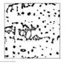 Fig. 01 - Localization of a valid area of a blood smear