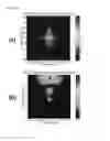 Fig. 07 - Adaptive high speed/high resolution 3D image reconstruction method for any measurement distance