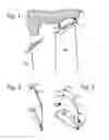Fig. 02 - Aircraft engine blading