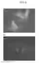 Fig. 06 - COMPOSITIONS AND METHODS FOR DETECTING OR ELIMINATING SENESCENT CELLS TO DIAGNOSE OR TREAT DISEASE