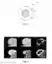 Fig. 02 - Nanoparticle composition and associated methods thereof