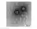 Fig. 01 - Bacteriophage of the siphoviridae family and antibacterial compositions comprising the same