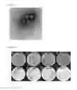 Fig. 02 - Bacteriophage of the siphoviridae family and antibacterial compositions comprising the same