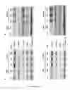 Fig. 04 - Methods and Compositions for Treatment of Tumor Metastasis