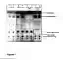 Fig. 02 - Genetically modified organism for the production of lipids
