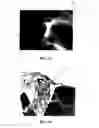 Fig. 02 - Conformable tissue repair implant capable of injection delivery
