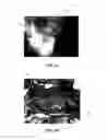 Fig. 04 - Conformable tissue repair implant capable of injection delivery