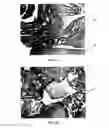 Fig. 07 - Conformable tissue repair implant capable of injection delivery