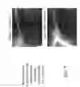 Fig. 05 - Myeloid derived suppressor cell inhibiting agents