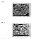 Fig. 10 - PARTICLES OF DOPED LITHIUM COBALT OXIDE, METHOD FOR PREPARING THE SAME AND THEIR USE IN LITHIUM ION BATTERIES