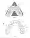 Fig. 02 - Tooth positioners, method of making the same, and method of positioning teeth using the same