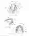 Fig. 03 - Devices and methods for creating a positive pressure environment for treatment of oral biofilms associated with periodontal disease