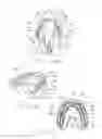 Fig. 06 - Devices and methods for creating a positive pressure environment for treatment of oral biofilms associated with periodontal disease