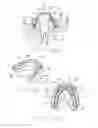 Fig. 08 - Devices and methods for creating a positive pressure environment for treatment of oral biofilms associated with periodontal disease