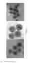 Fig. 02 - Multifunctional particles providing cellular uptake and magnetic motor effect