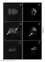 Fig. 04 - Multifunctional particles providing cellular uptake and magnetic motor effect