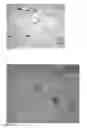 Fig. 07 - Device and methods for the detection of cervical disease