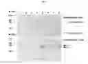 Fig. 02 - DETECTION AND QUANTITATION OF URINE GELSOLIN