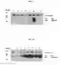 Fig. 03 - DETECTION AND QUANTITATION OF URINE GELSOLIN