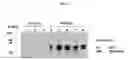 Fig. 04 - DETECTION AND QUANTITATION OF URINE GELSOLIN