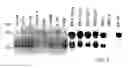 Fig. 06 - Tumor Suppressor Gene