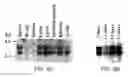 Fig. 07 - Tumor Suppressor Gene