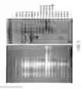 Fig. 10 - Tumor Suppressor Gene