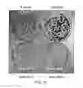 Fig. 11 - Tumor Suppressor Gene
